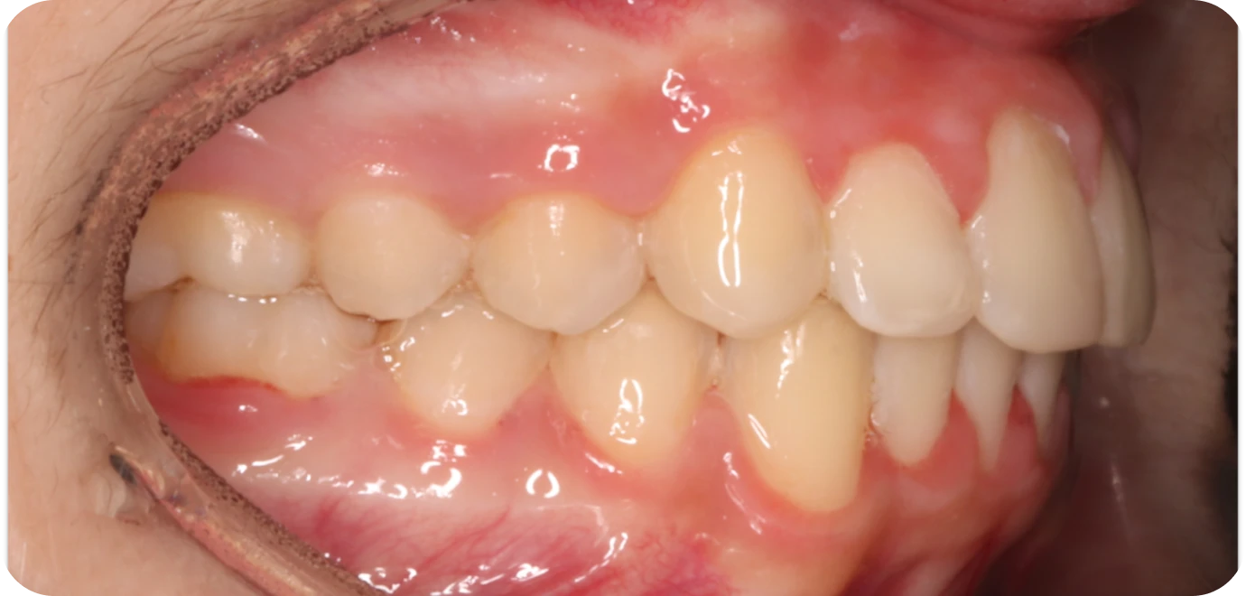 Processed - Man holding beer