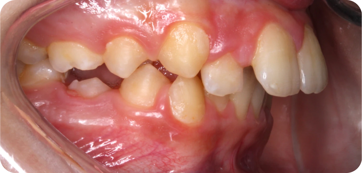 Original - Man holding beer