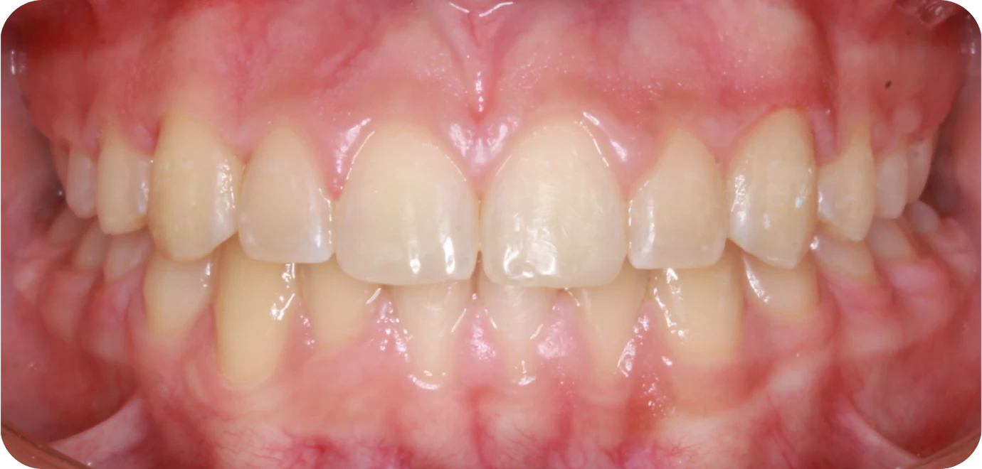 Processed - Man holding beer