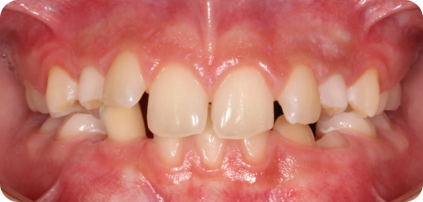 Original - Man holding beer