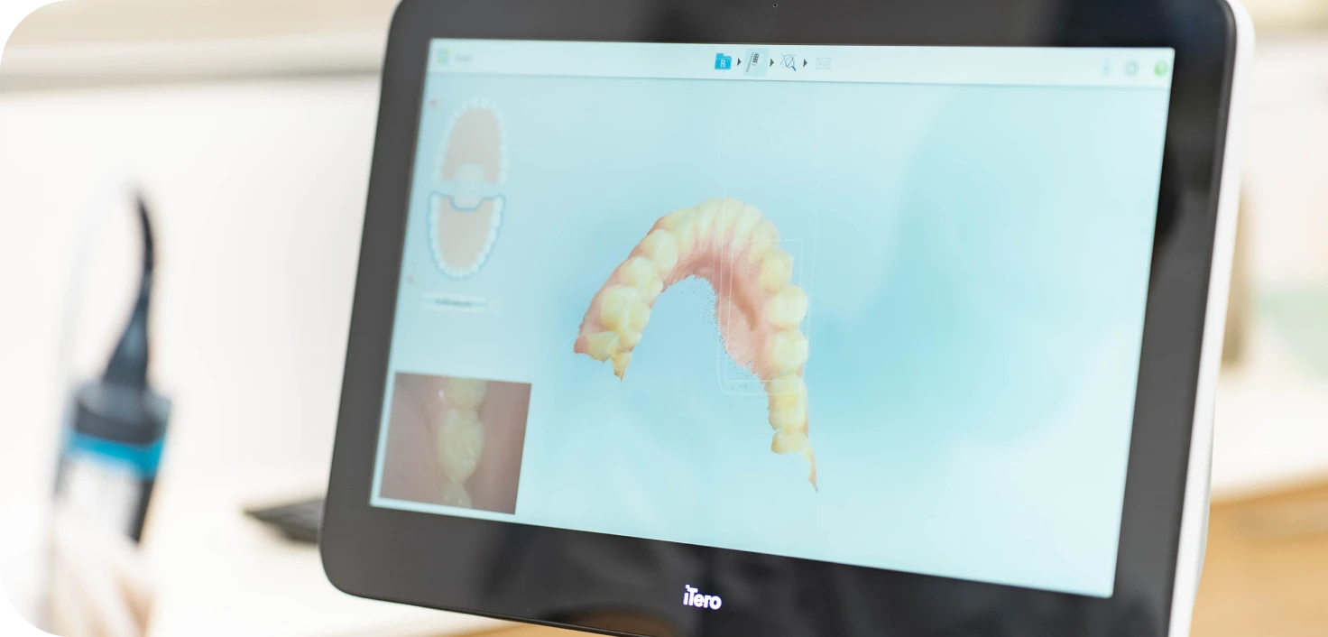 empreinte optique numerique